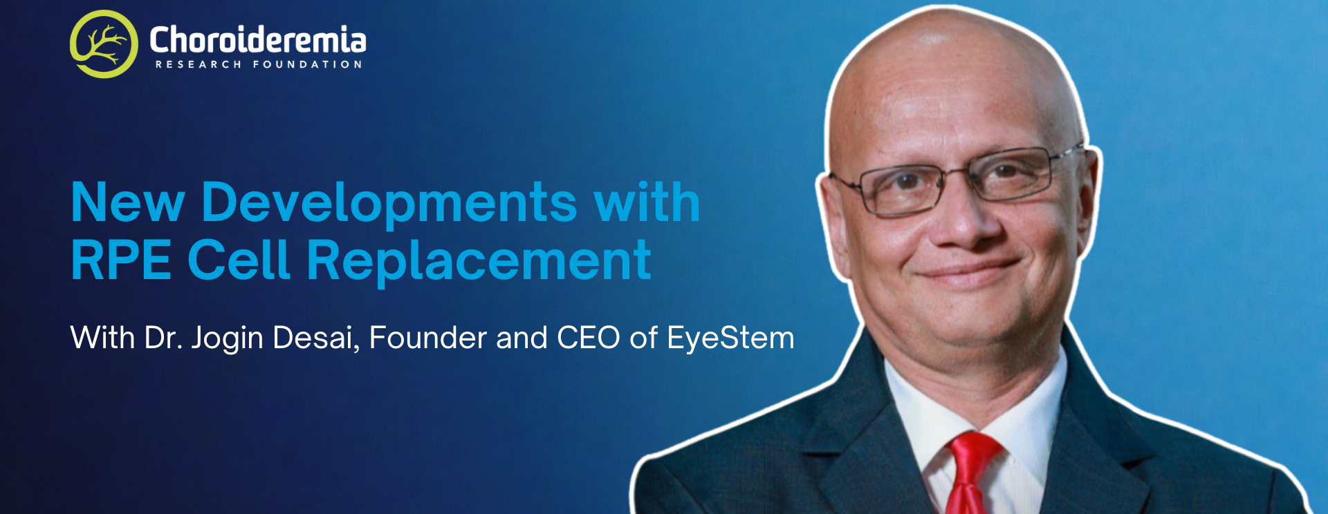 New Developments with RPE Cell Replacement